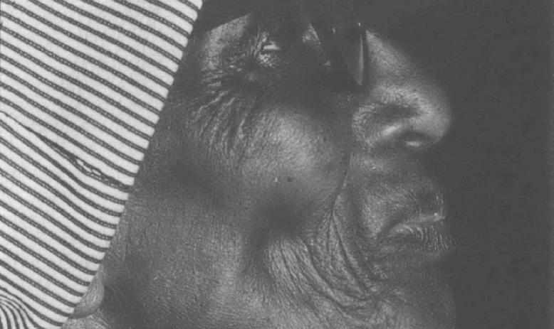 Black and white side profile photo of older Black woman wearing a hat and looking up