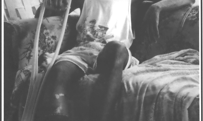 man in tank top seated on a couch by a window facing camera holding a single crutch